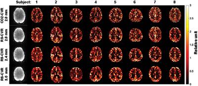 Dependence of resting-state-based cerebrovascular reactivity (CVR) mapping on spatial resolution